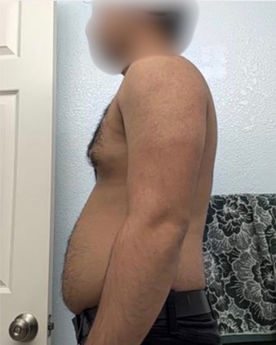 Client 4 before