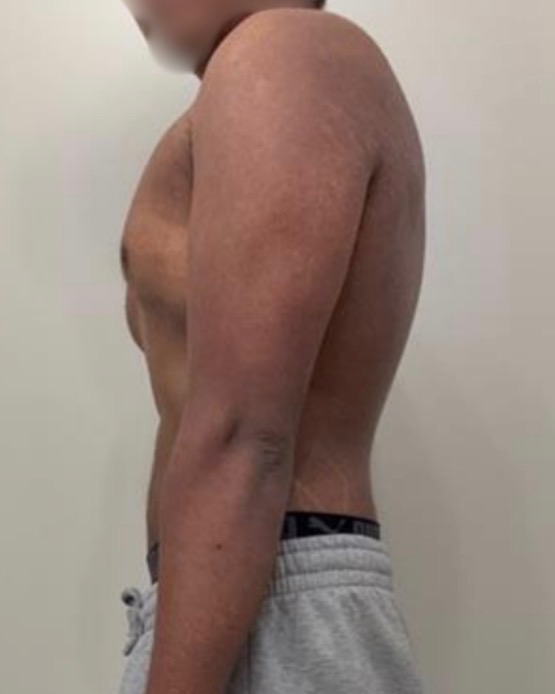 Client 4 after