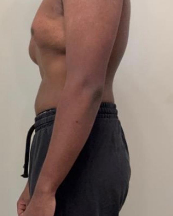 Client 6 before